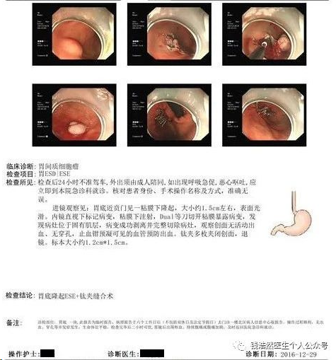 一个月内能否进行二次胃镜，探讨胃镜检查的频率与安全性