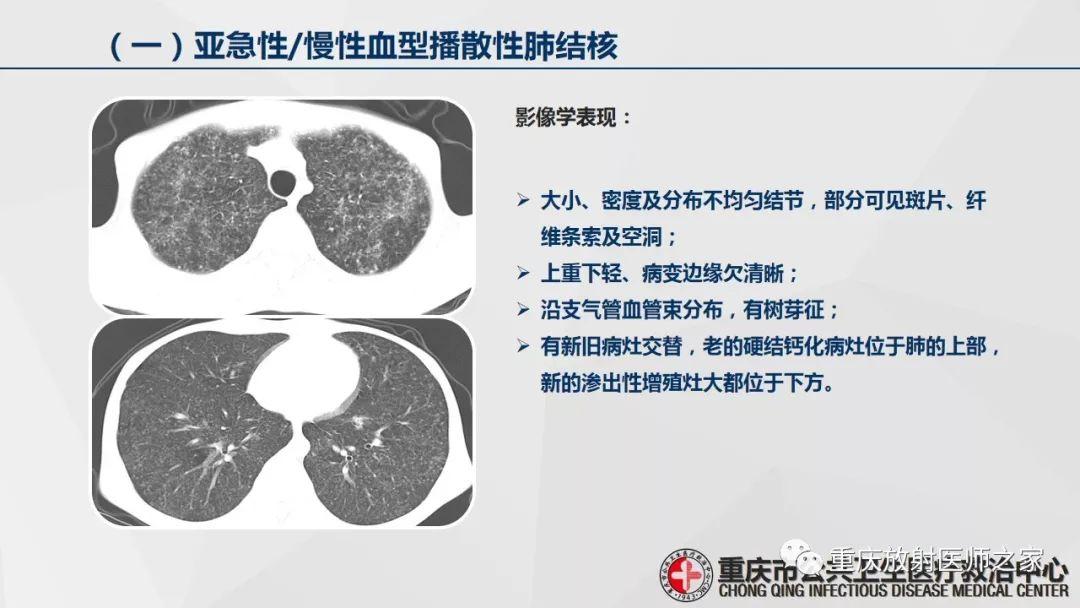 关于18个月宝宝咳嗽的探讨