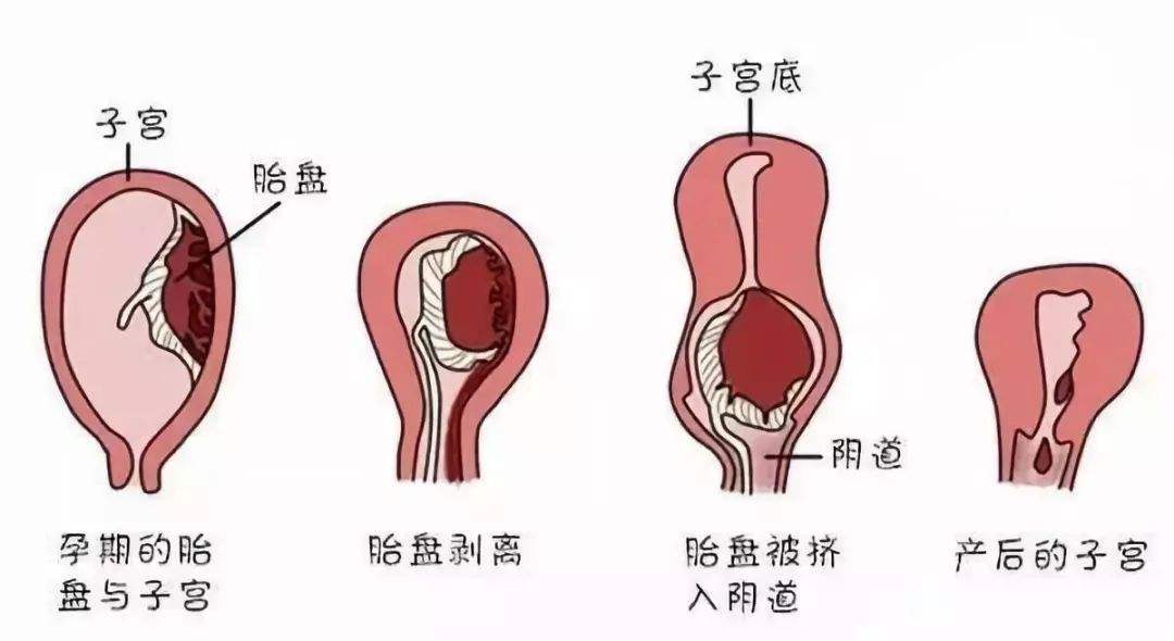 流产后四个月的身体与心理恢复之旅